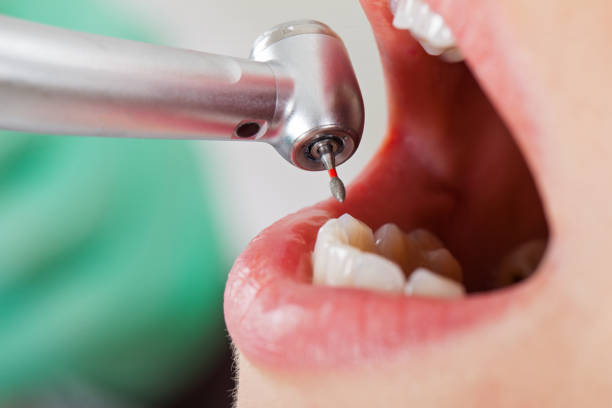 Best Emergency Treatment for Dental Infections or Abscesses in Traer, IA